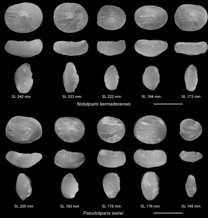 Human Otoliths